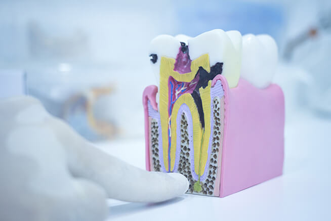 Pós Graduação em Aperfeiçoamento em Endodontia (Profa. Cristiane Bonanato Estrela)